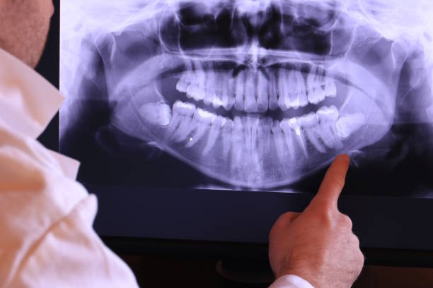 Best Urgent Tooth Repair  in Covedale, OH