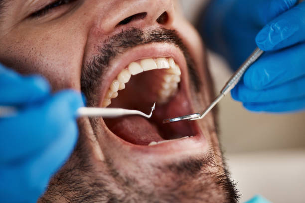 Best Emergency Gum Pain Relief  in Covedale, OH